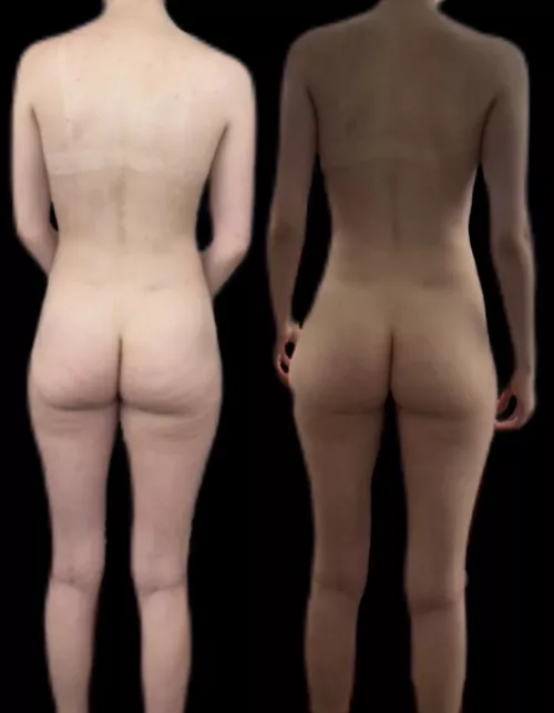 F23/5’9/138 - direct light standing naturally vs indirect light w/ slight pelvic tilt, feet farther apart & shoulders back