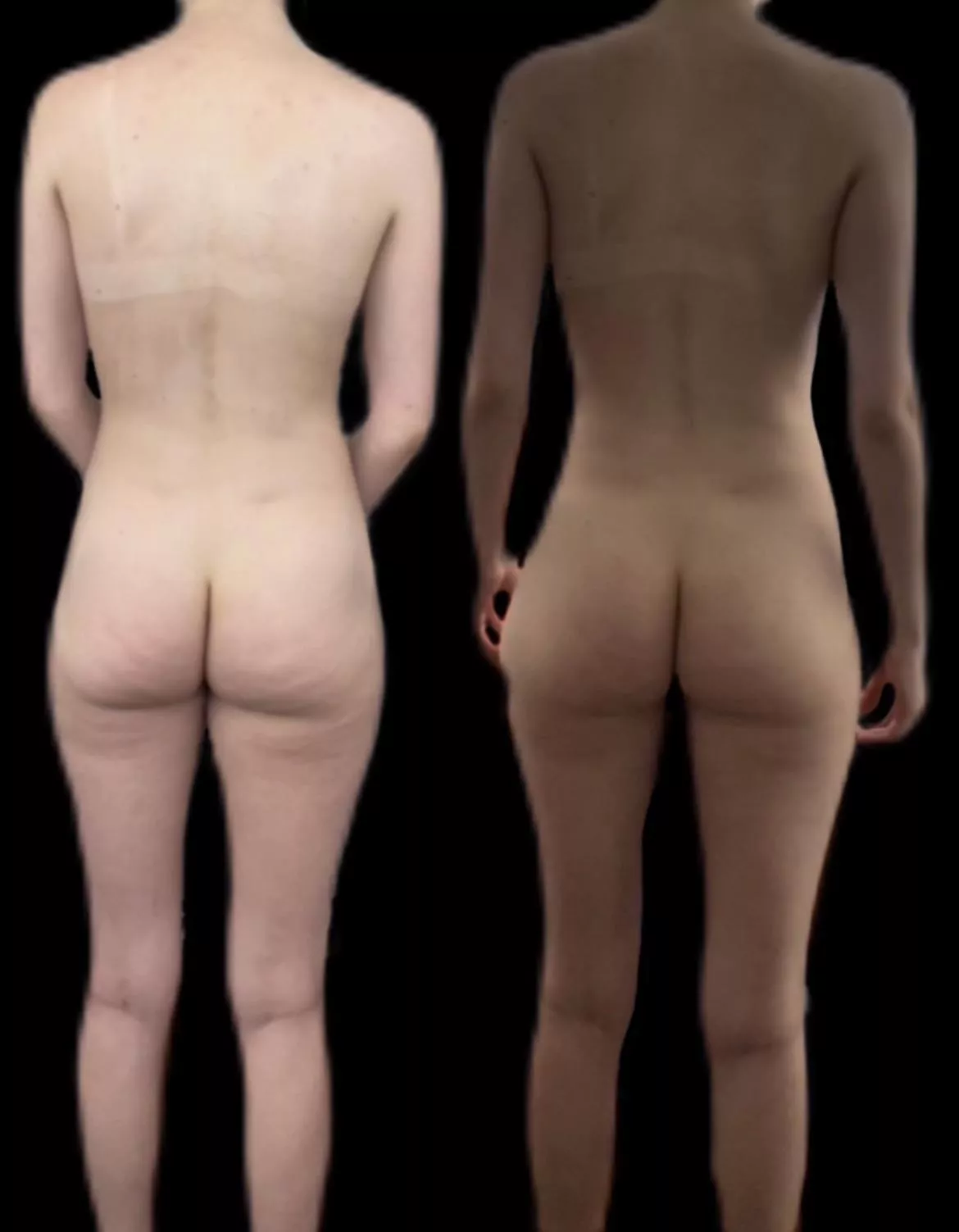 F23/5’9/138 - direct light standing naturally vs indirect light w/ slight pelvic tilt, feet farther apart & shoulders back