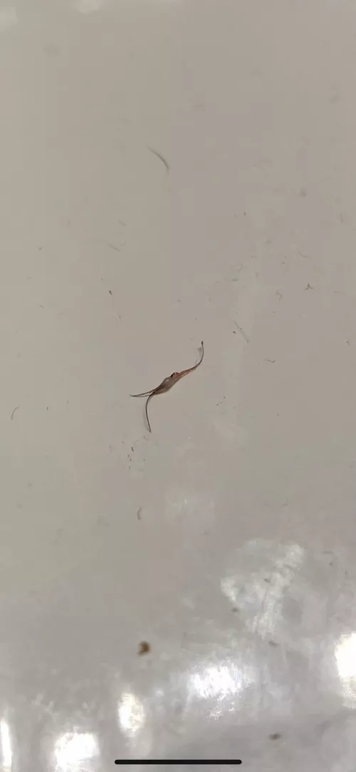 Finally got this thing out of my body after a month of squeezing and poking