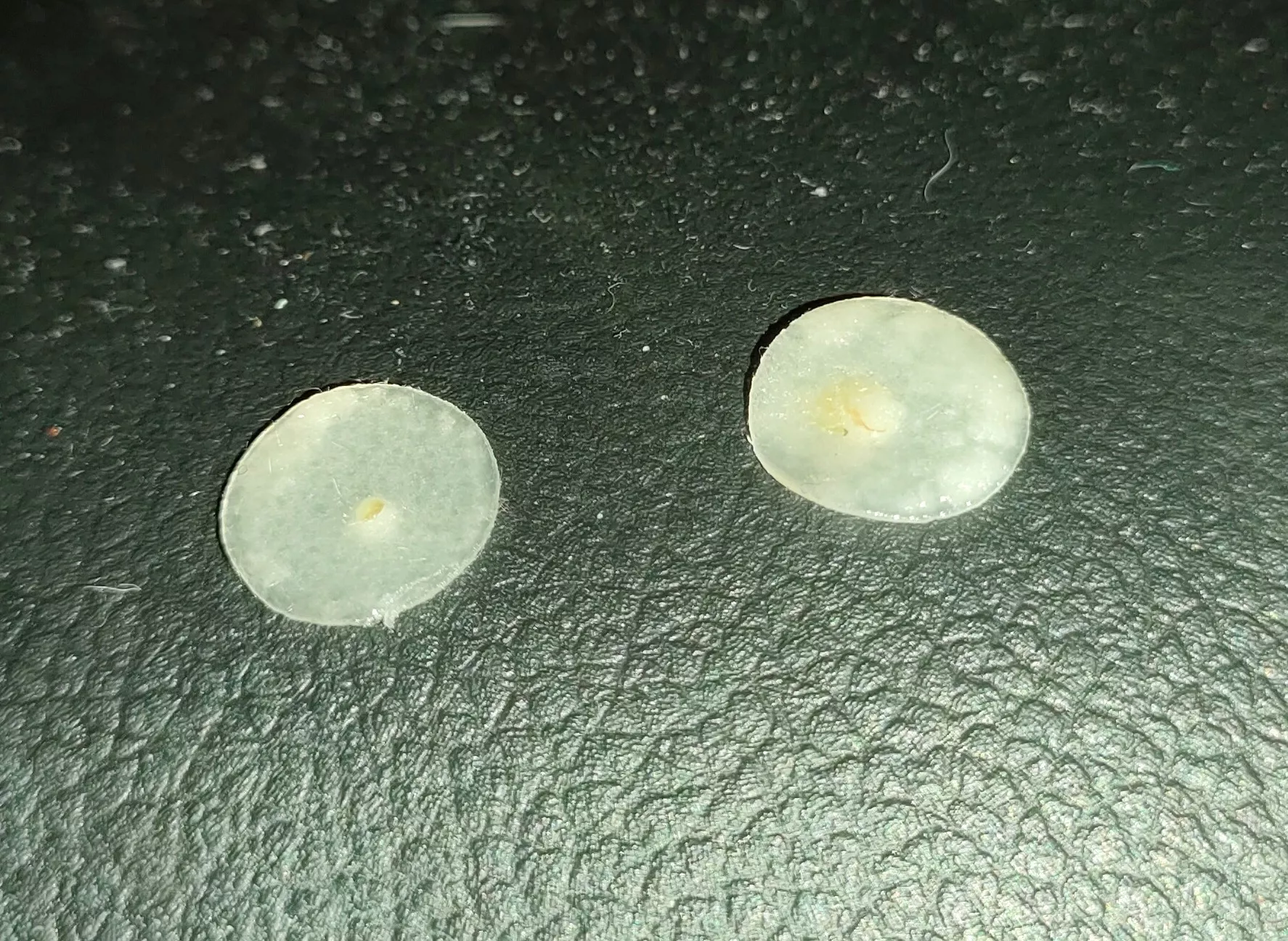 Forgot about my pimple patch for 8 hours, here's what it zapped up