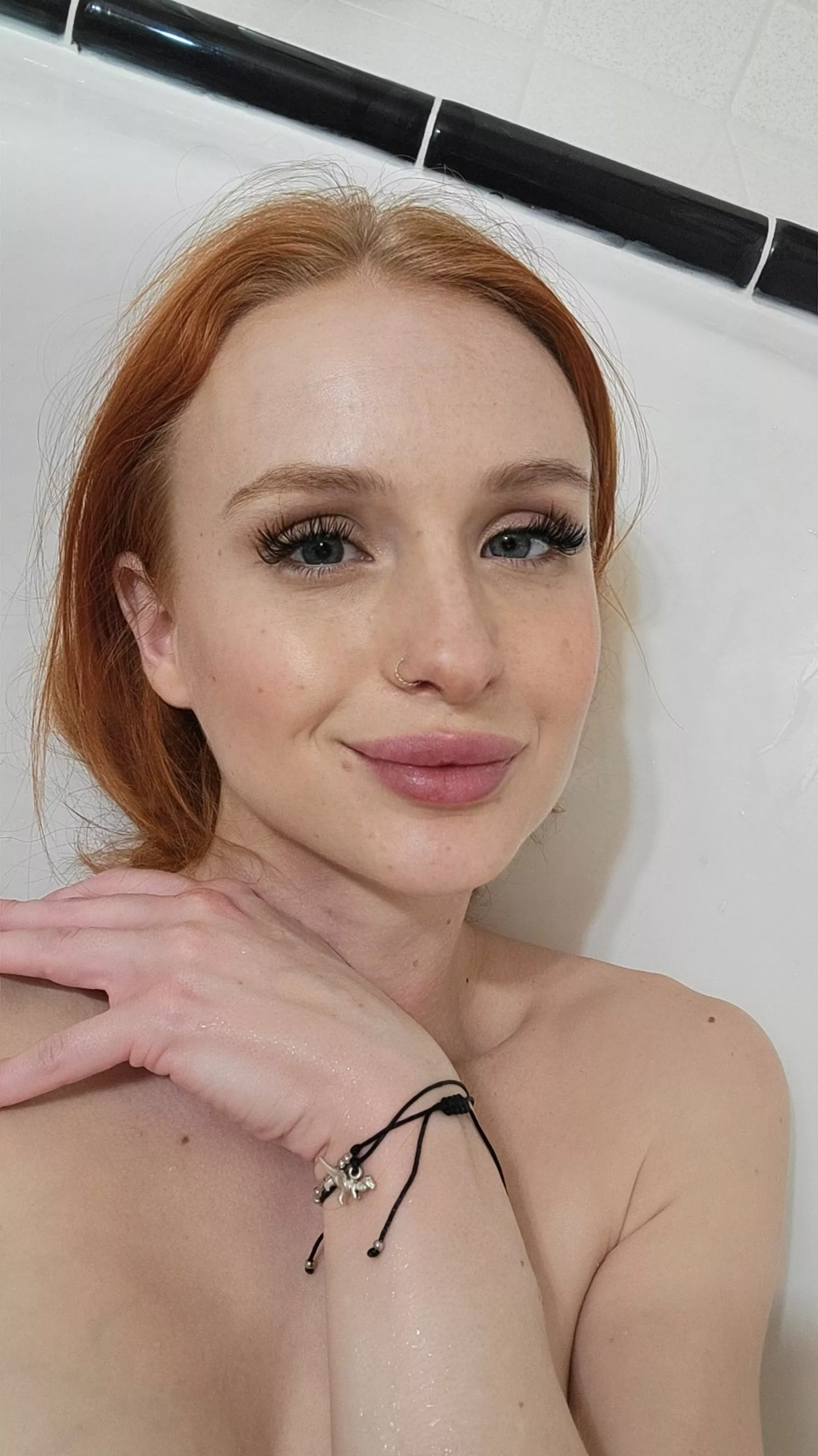 freckles>everything else