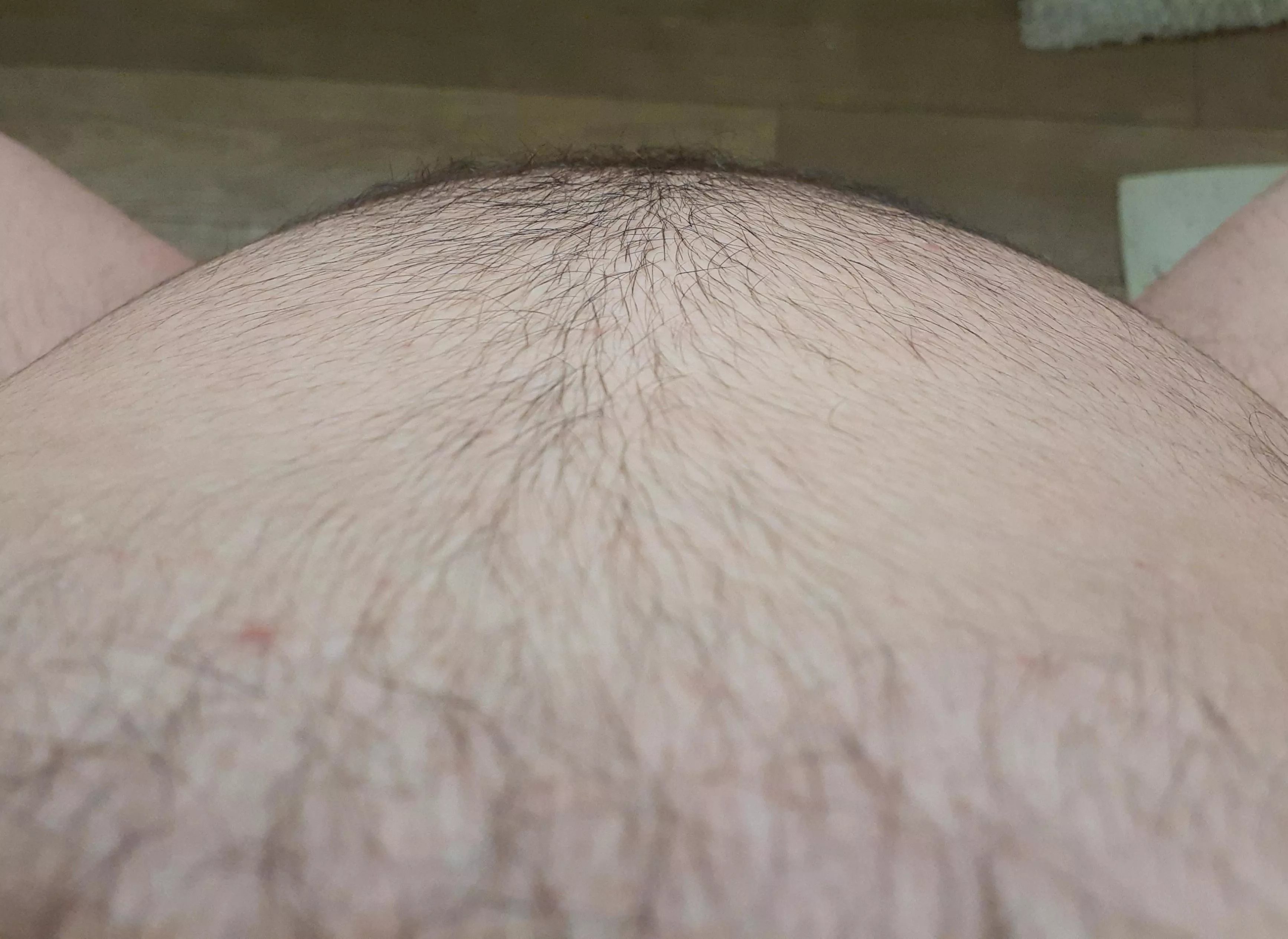 (FtM) So full of eggs 🥵 What kind do you think they are?