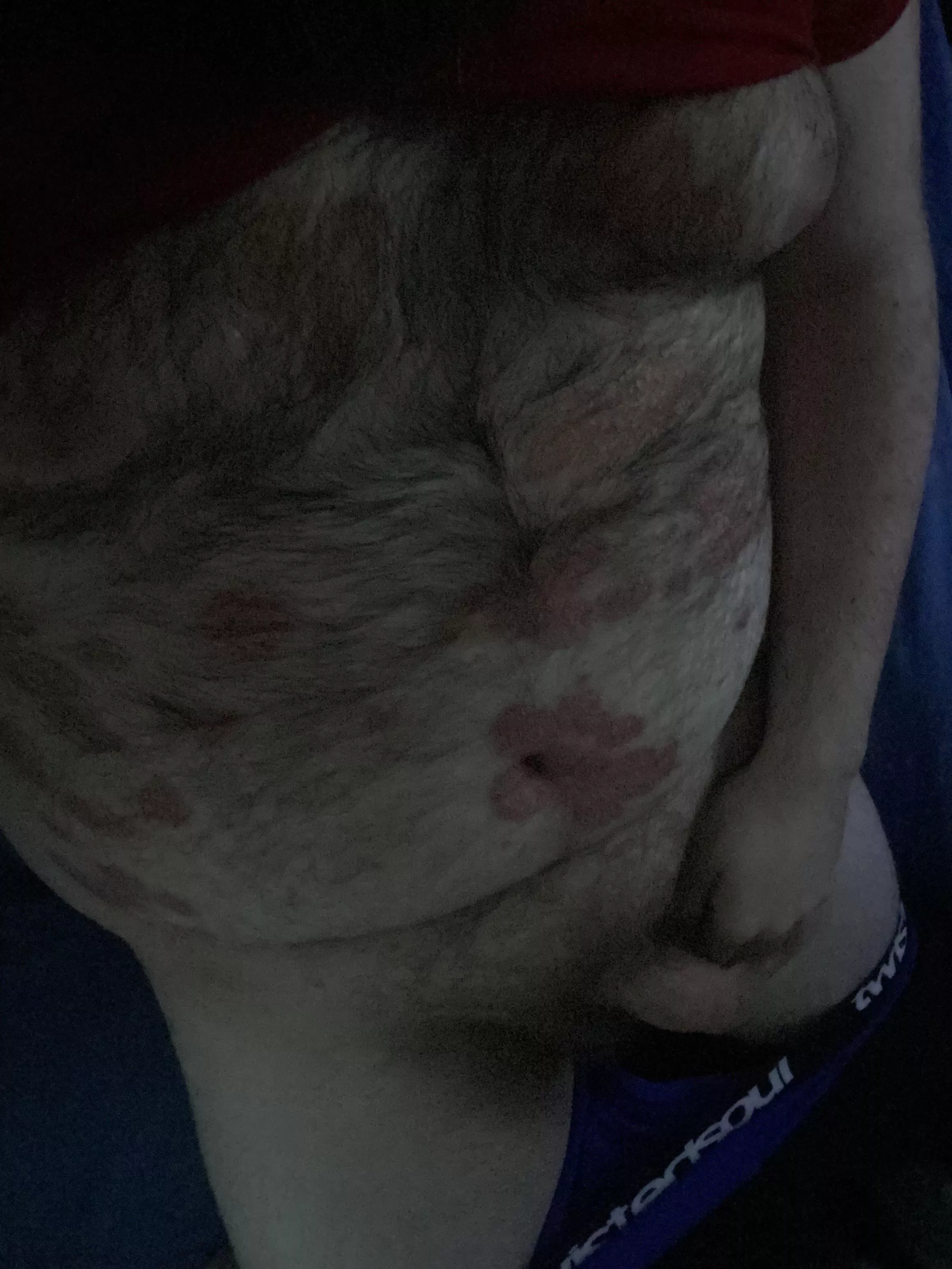 Got tired of having to hide it but I’m just gonna show off my true self, got some bad skin but I’m still hot af