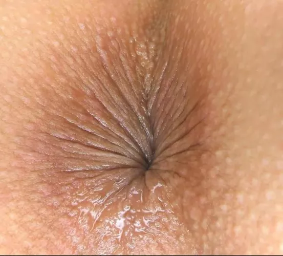 here is my asshole close up , do you like it ? 51 (f)