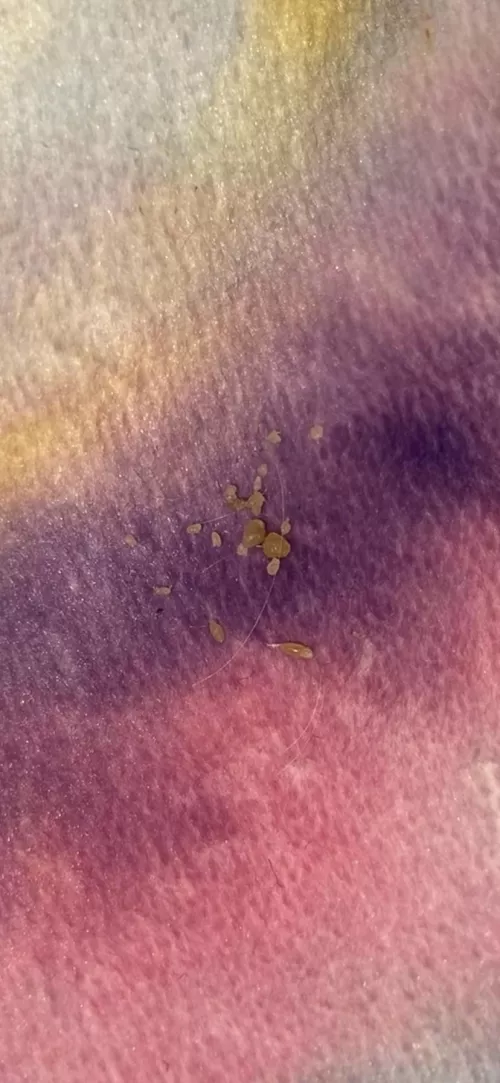 I call these ‘skin seeds’