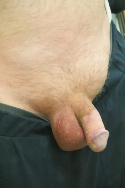 I had shaved my pubes; but luckily, now the ginger glow is back! Grateful! Never shave again!