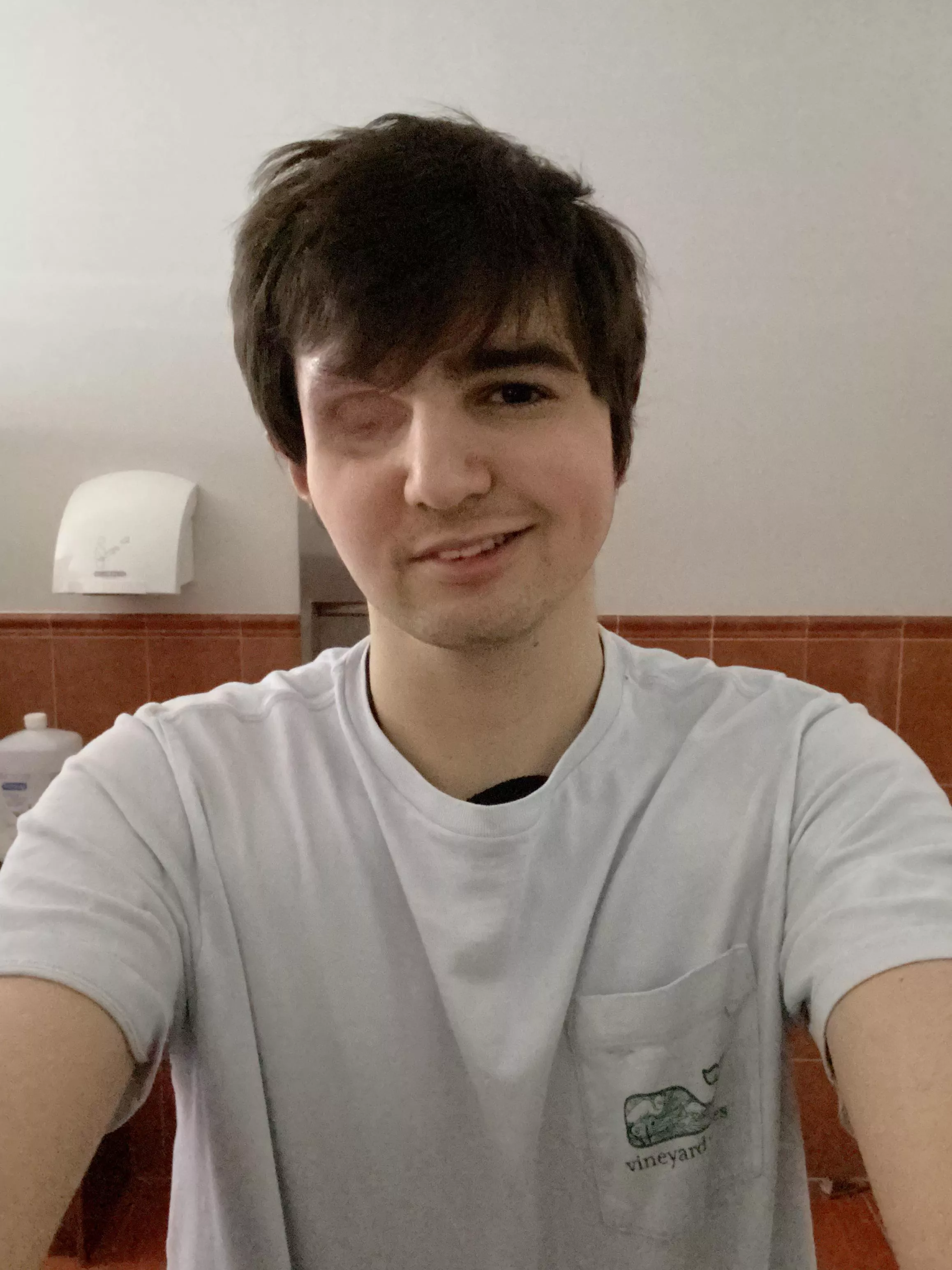 I hate how much I let my missing eye and missing hair on my right side control me. I wish I could just go out and somehow not be self conscious. But it’s looking impossible. Please appreciate your image even if you don’t like it. It changes everythin
