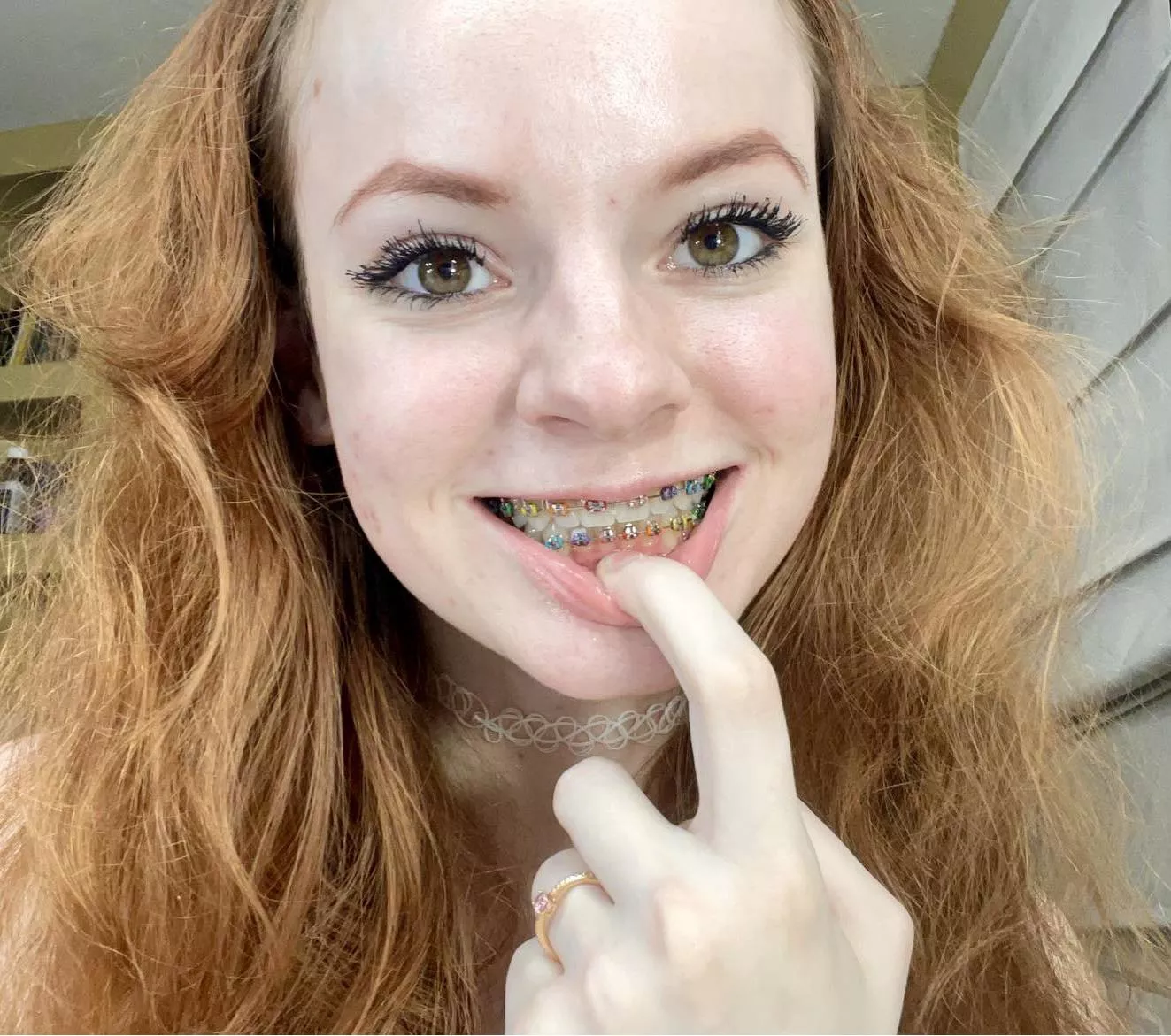 I love my braces ❤️ I never want them taken off