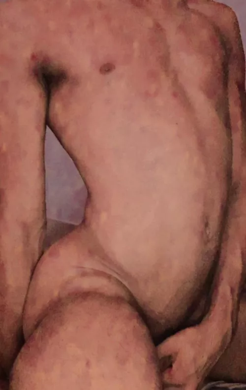 I need more than a hug 👀 snp: dracukkeox