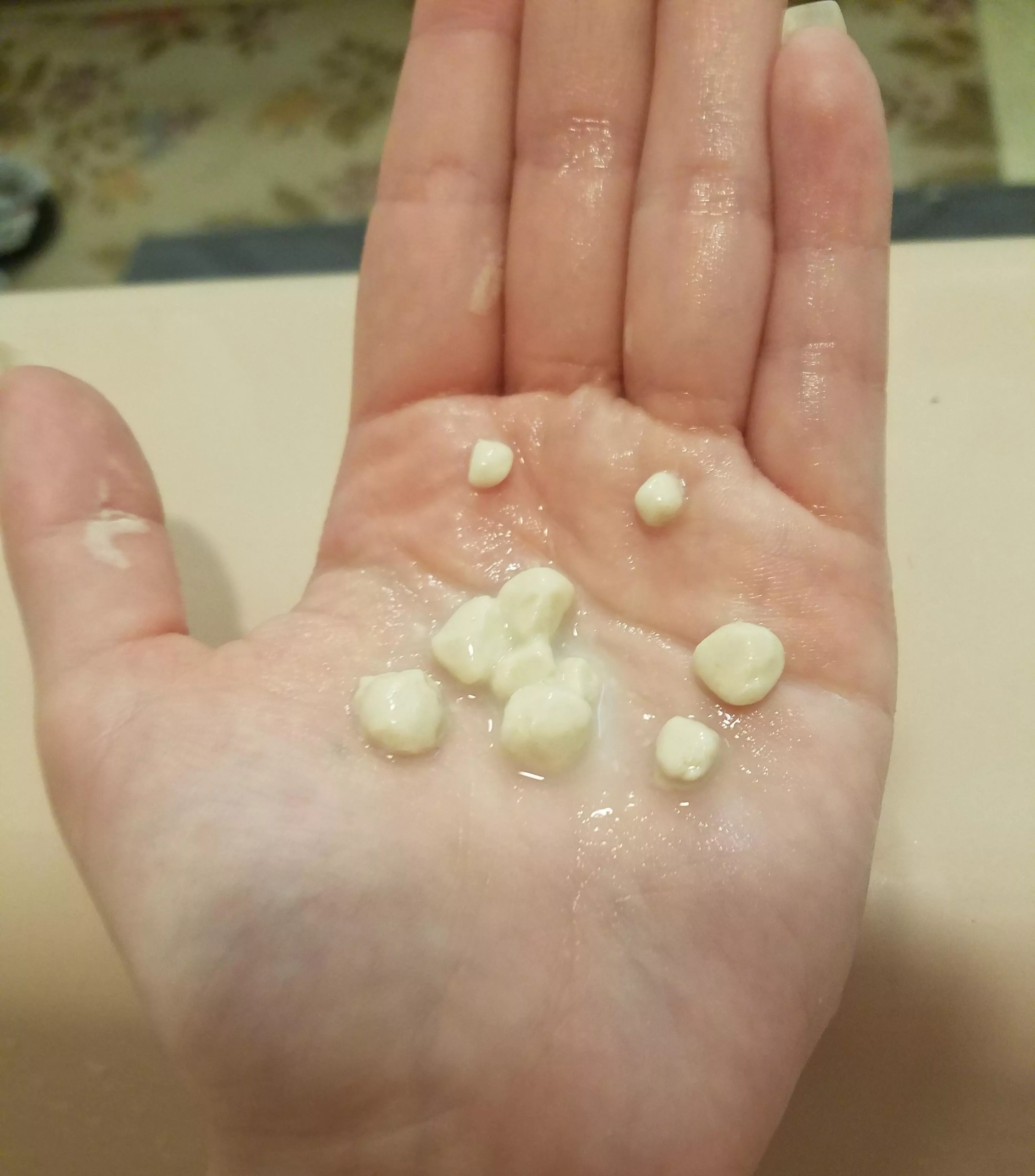I take baths in colloidal oatmeal to help moisturize my dry skin. When it clumps up it looks a lot like tonsil stones.