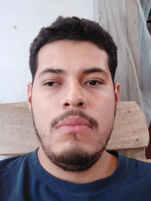 I used to dislike my lazy eye, now I embrace it as something that makes me different. What do you think?