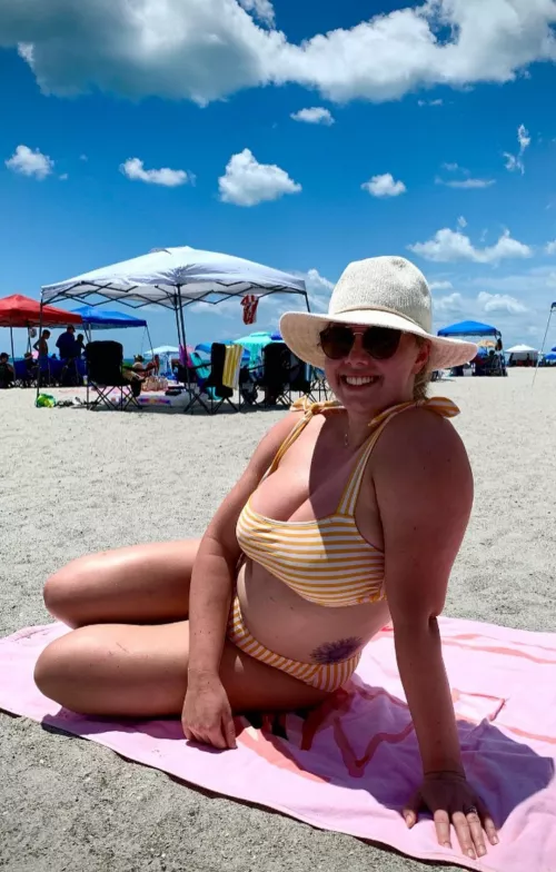 Im (f)eeling the sunburn from this weekend