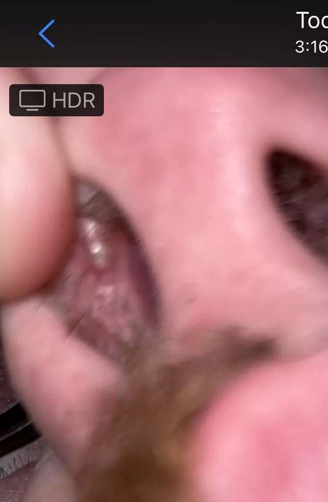 It'll be impossible to film without help, but know that this is the most annoying thing I've ever dealt with