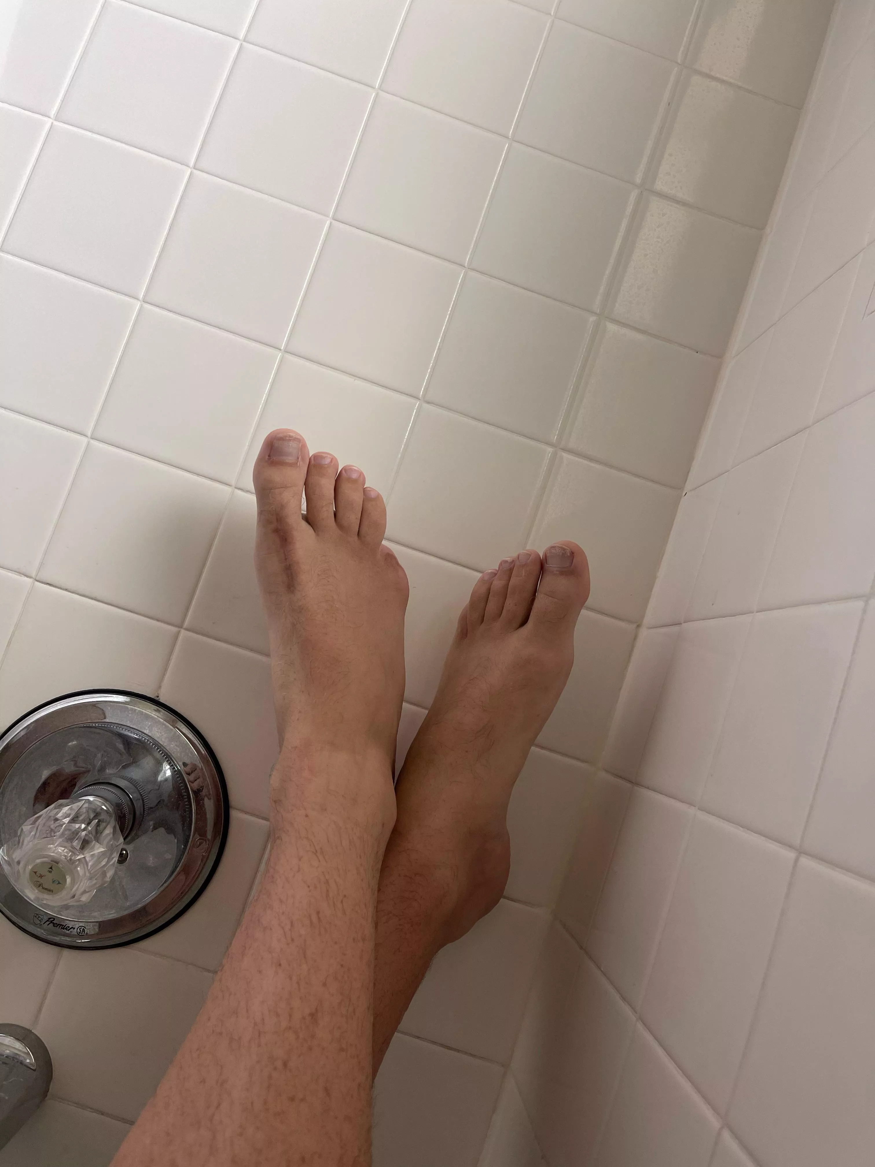 It’s my cake day, so here are my nine toes It’s my cake day, so here are my nine toes