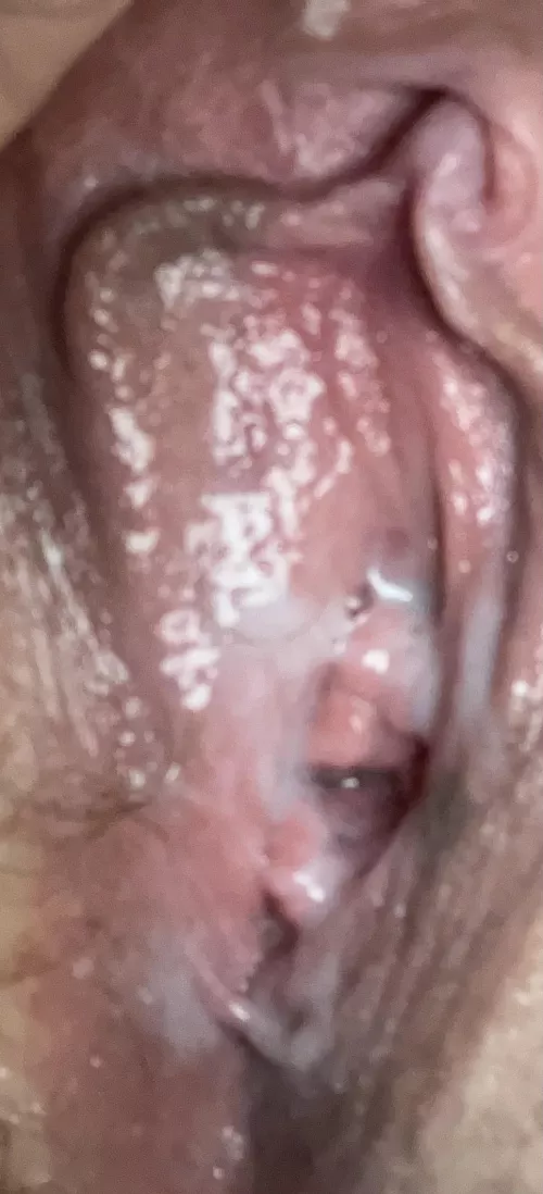 It’s so sensitive now