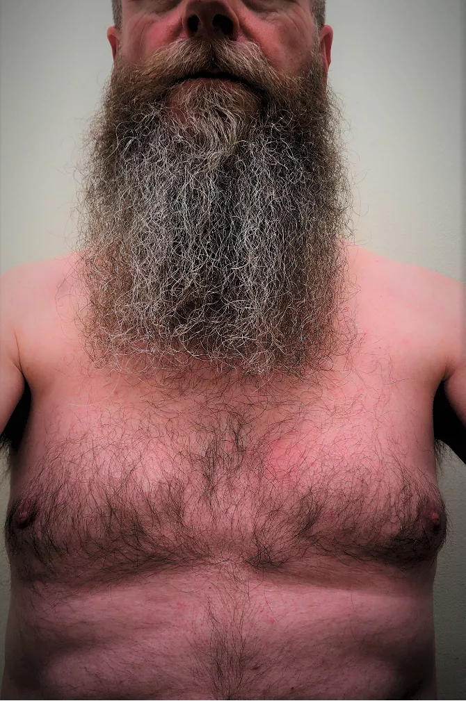 Let me introduce myself: Beard and chest hair; tomorrow the rest will follow! 😉 [46]