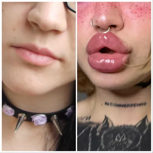 Lips are important 🥰