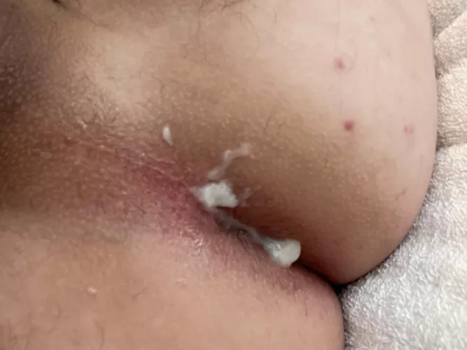 Little bit of glaze on my donut hole 😉