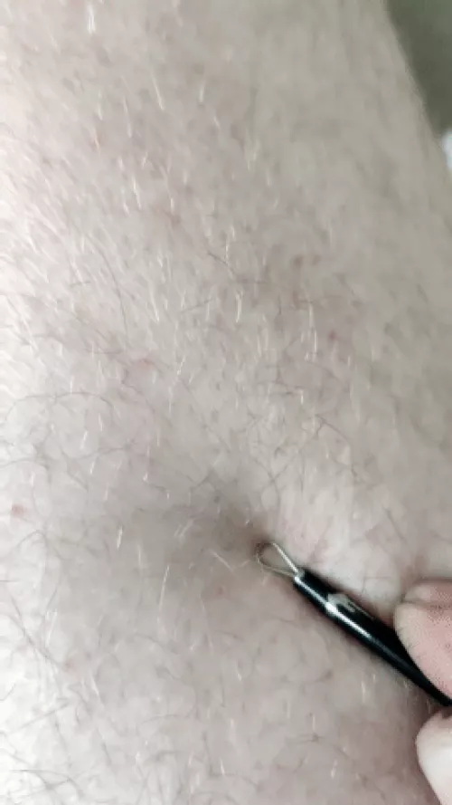 Little Whitehead on my leg