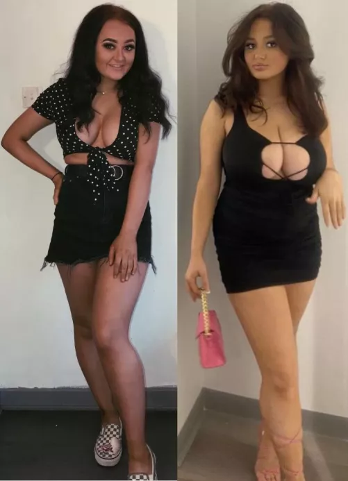 Mia.ely huge breast growth