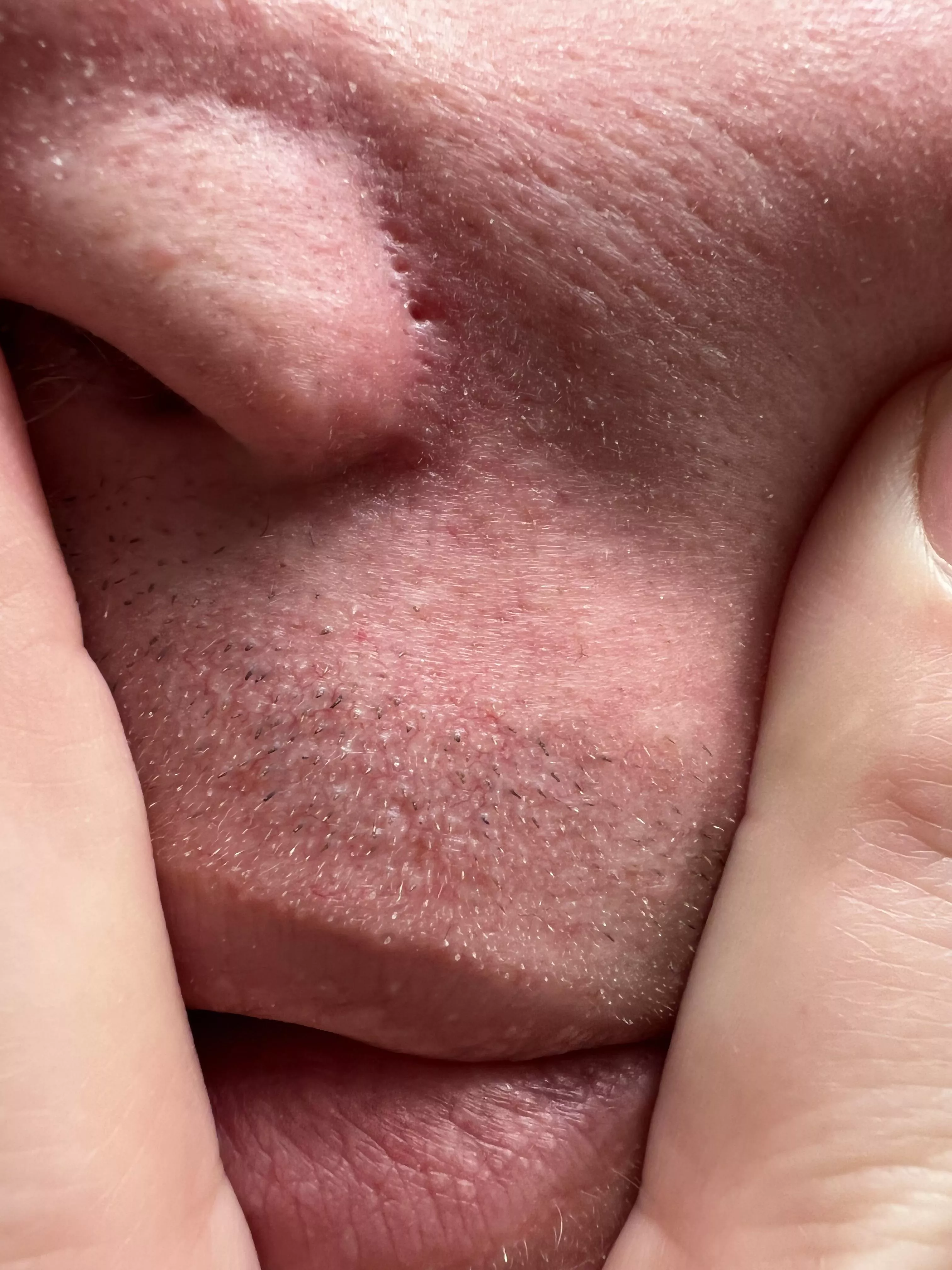 Missed the pop but here’s the hole it left.