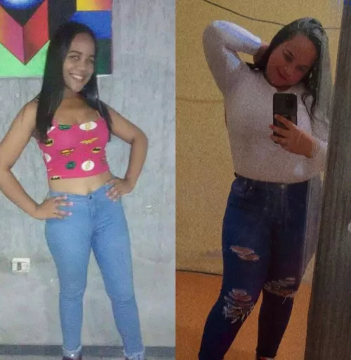 my before and after is amazing i love my body the way it is now thanks to all the feeders 🙏🏼🤩😍