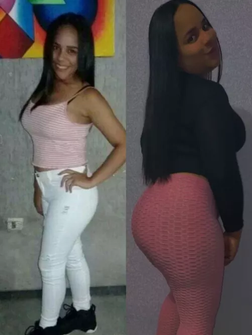 my before and after is totally amazing 🤩