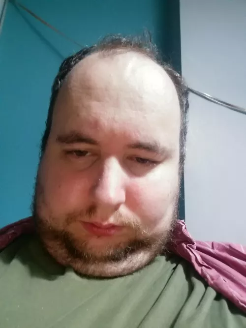 My bully has told me to post this: This guy is gay, ugly, has a tiny dick, is losing his hair and is very very fat. He's 24 stone/336 pounds. I'm telling him to post this around, if you want to bully him feel free, he's been told to deal with it. his 