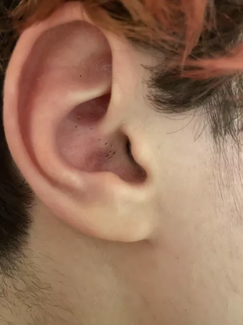 My teenager won’t let me touch his ear. These are taunting me!