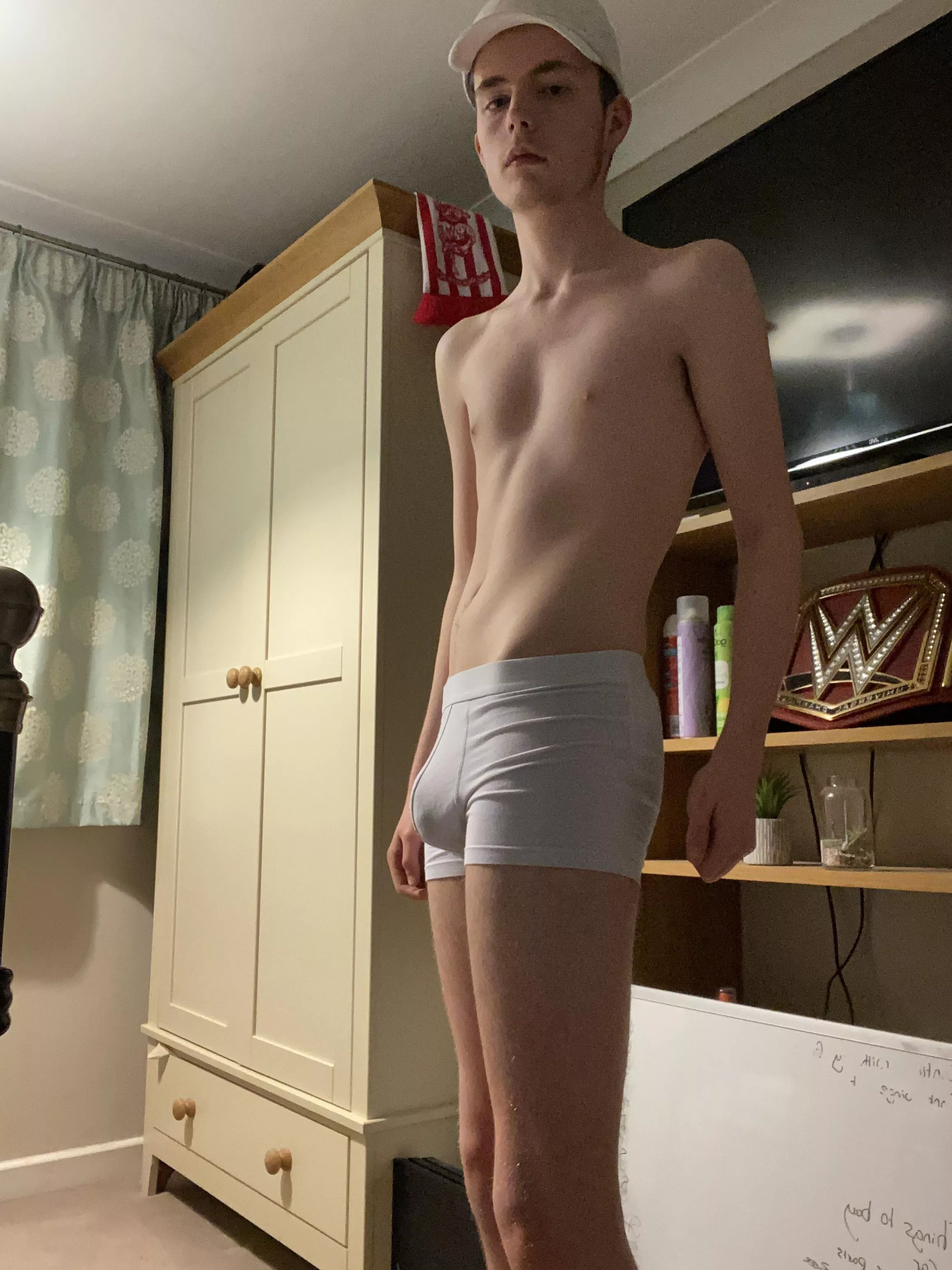 Nervous about my face 👉🏻👈🏻