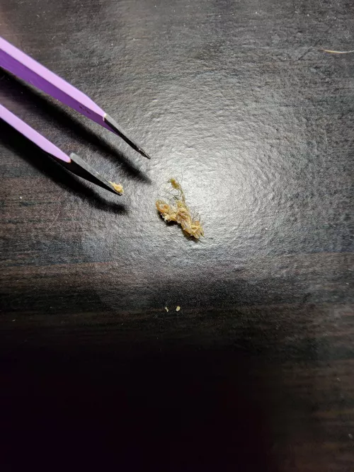 Not sure if this fits in this subreddit, but my wife just pulled this monstrosity out of my belly button