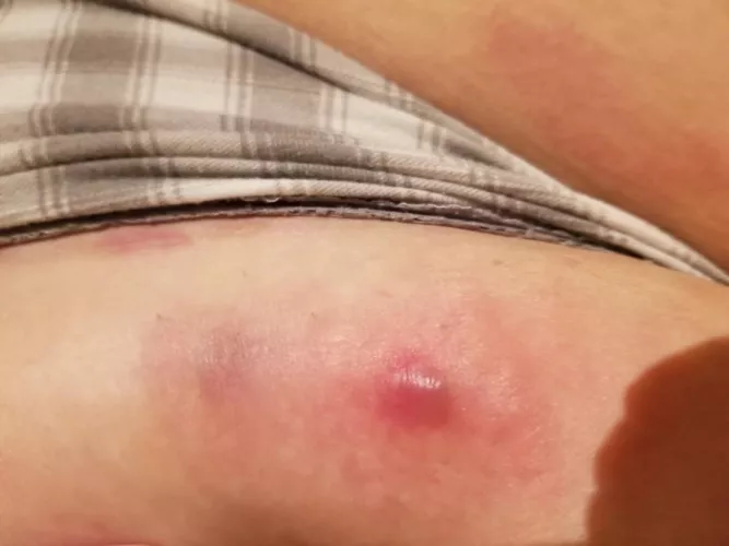 oh sweet jesus it's huge