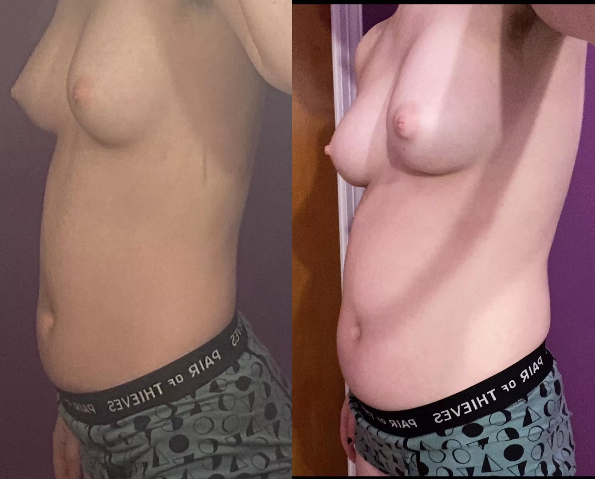 only a month and a half between these pics. u can imagine how much eating ive done..😵