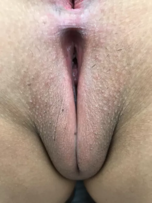 Oops…I missed a few stubbles I think!