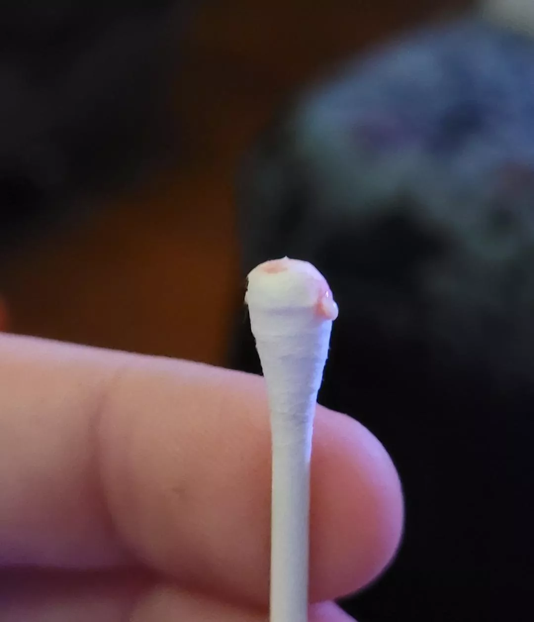 Painful and hard ear pop