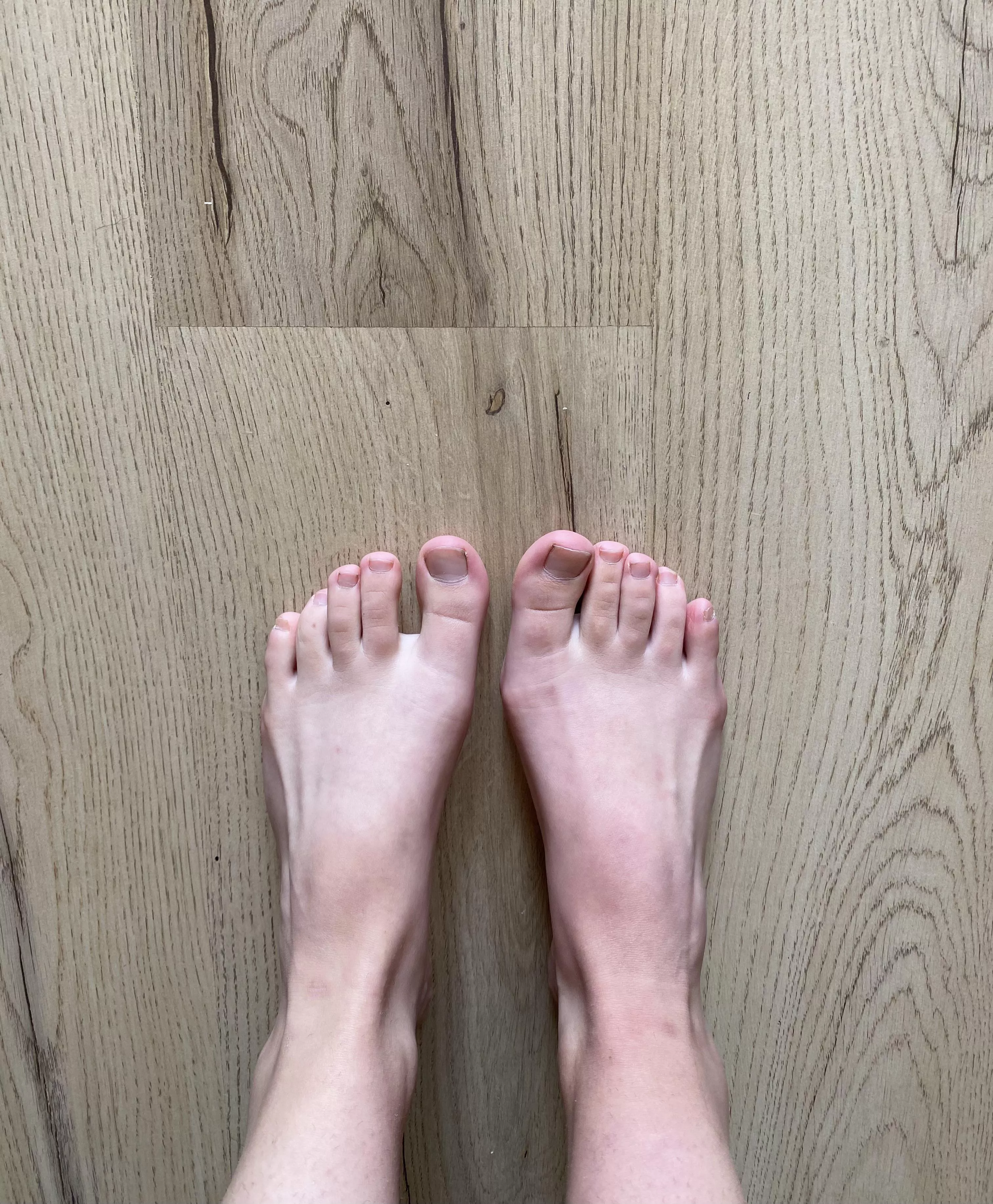 Plain toes 😅