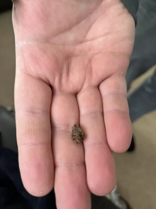 Presenting an ear raisin from my significant other who now has the ability to hear colors