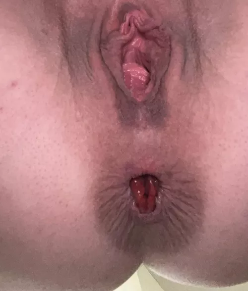 Puckering out. I think I’ll open it up soon and make it gape!