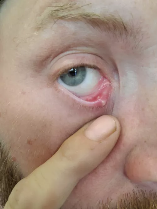 Quick update on the forbidden pop