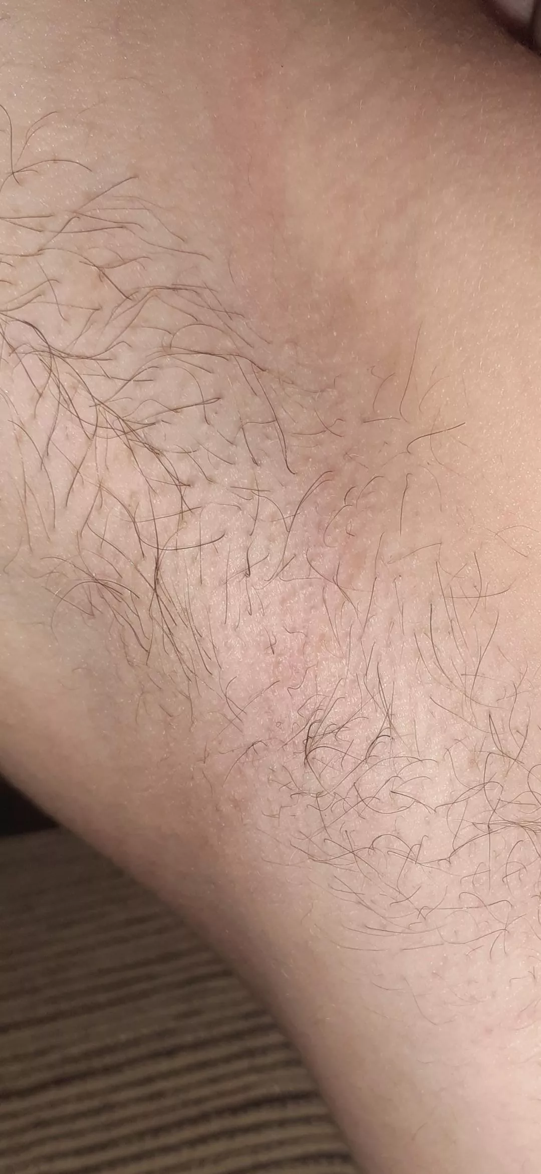 Rate my armpit!