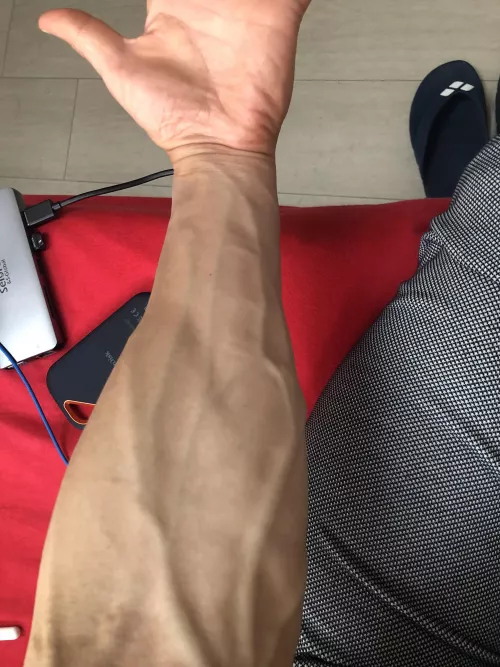 Saturday‘s forearm