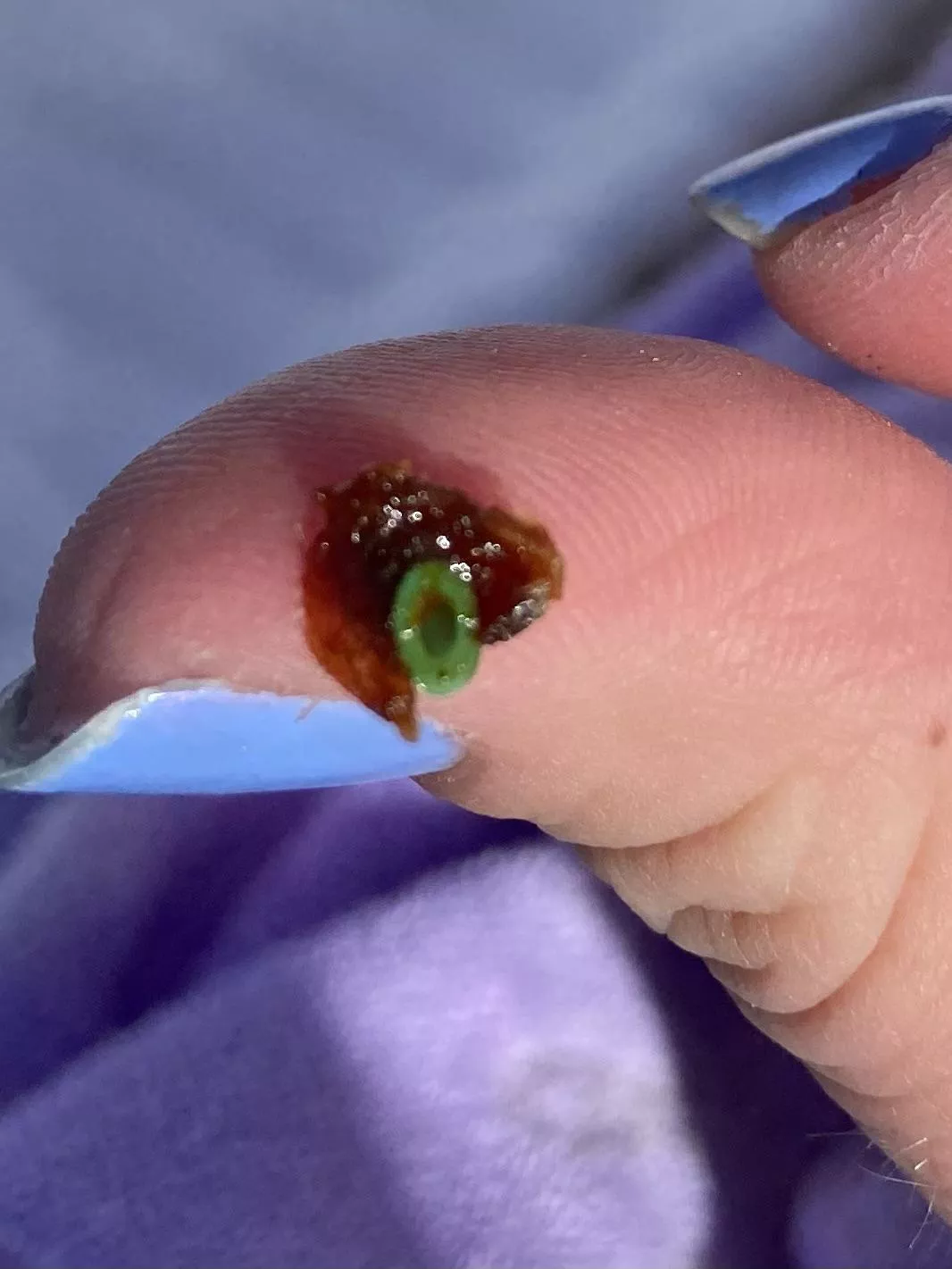 Saw something coming out of my daughter’s ear…her ear tube fell out along with a giant ball of earwax.