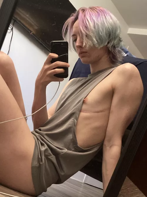 Scars healing well :)