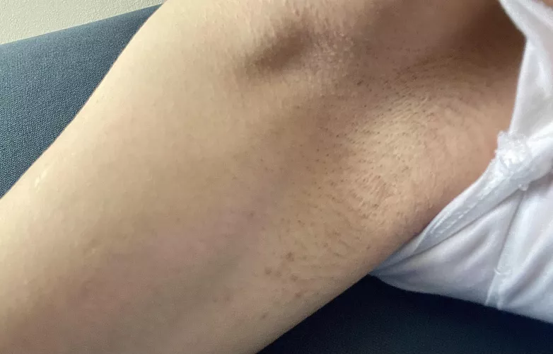 Shaved this morning, already stubbly 😅