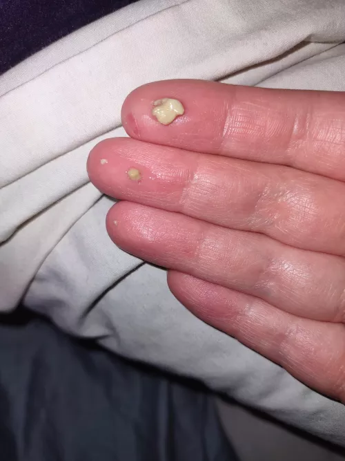 spit up a huge tonsil stone as i was trying to sleep 😭 it smelled so bad yall