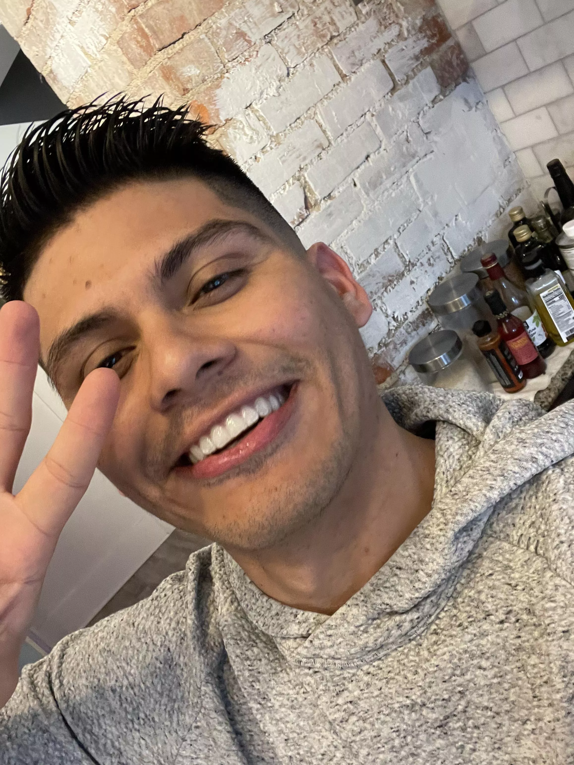 Started Invisalign today! Super excited :) Started Invisalign today! Super excited :)