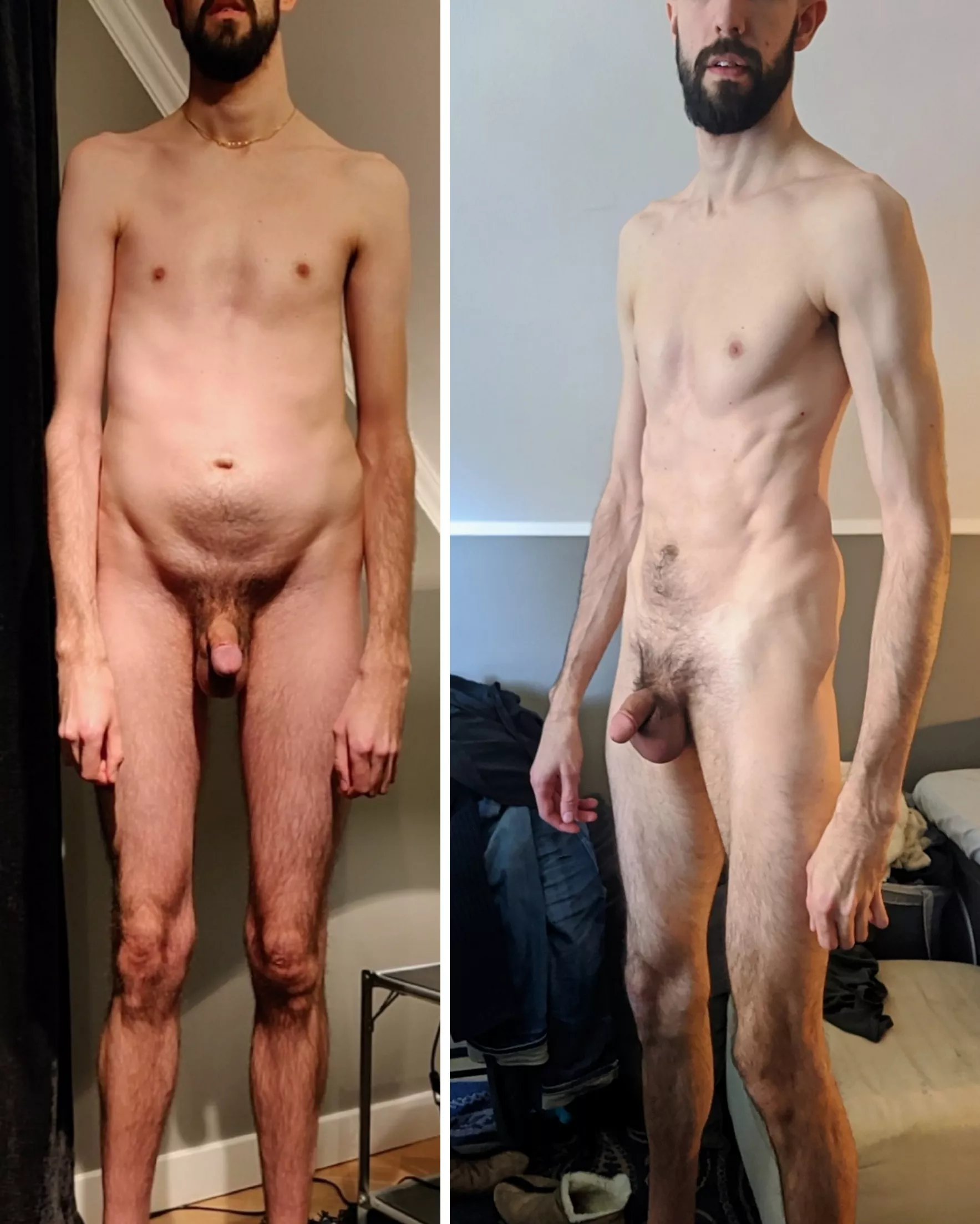 Started making changes at 27, now I'm 30 and I always need to look back to remember where I started to not lose hope. Weight is about the same in both pictures. Oh and I have Marfan's Syndrome in case you were wondering