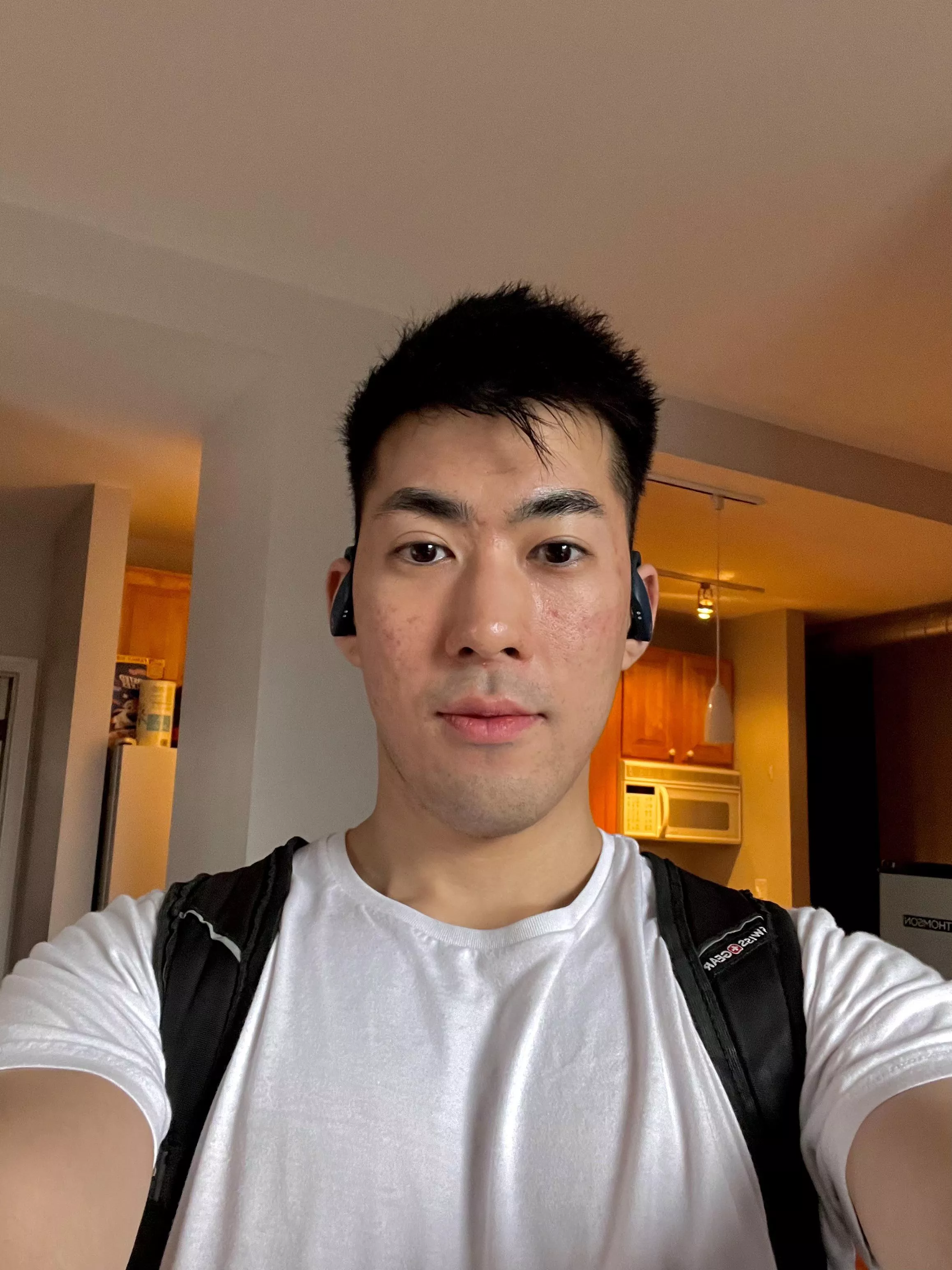 Started new acne medication 4 weeks ago, finally feels more under control Started new acne medication 4 weeks ago, finally feels more under control