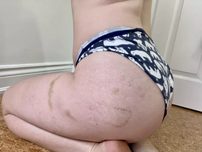 The aftermath of a little impact play [F]