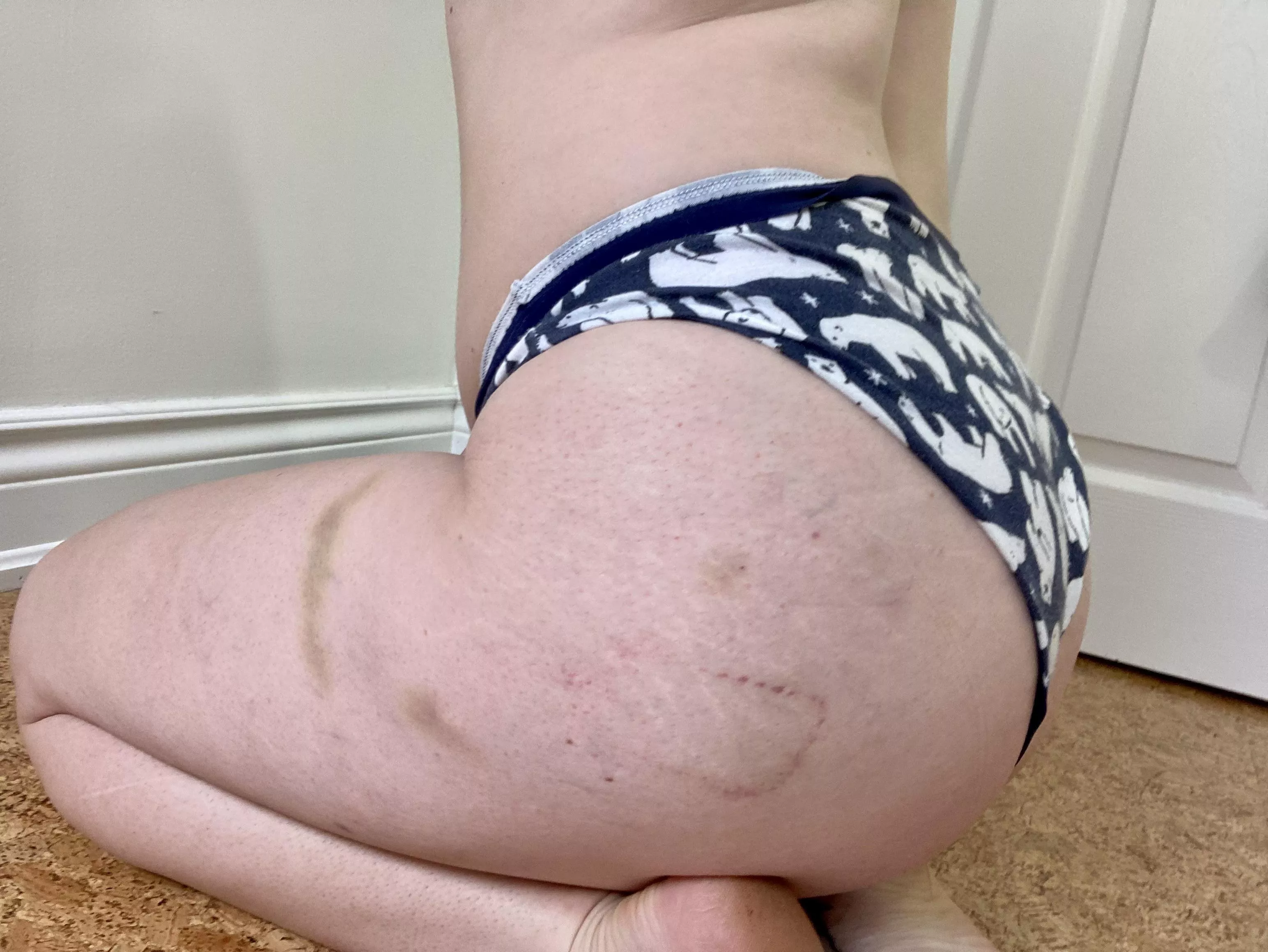 The aftermath of a little impact play [F]